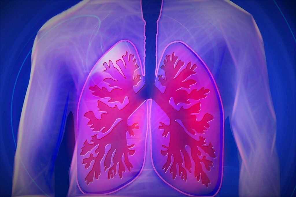 How to Recognize and Treat Pneumothorax (Collapsed Lung)